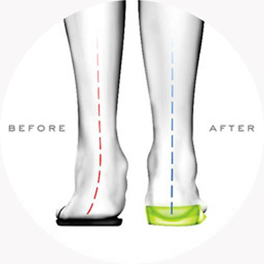 vionic replacement insoles
