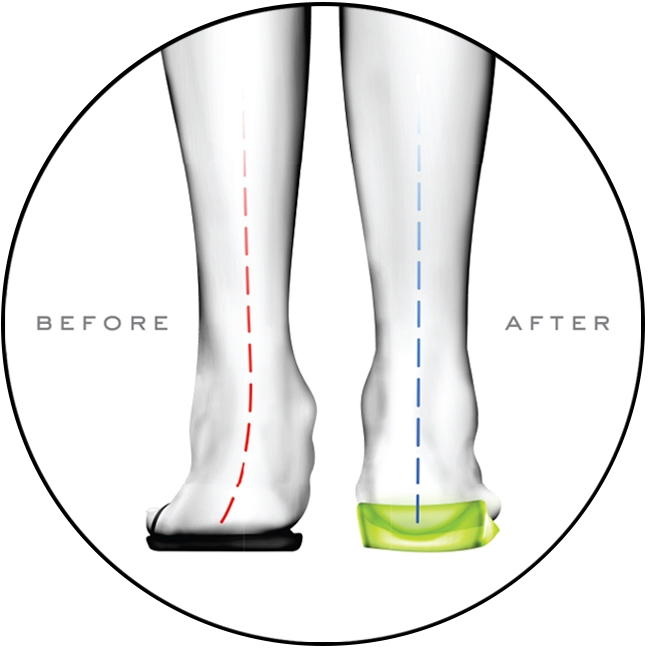 orthotic shoes for heel pain